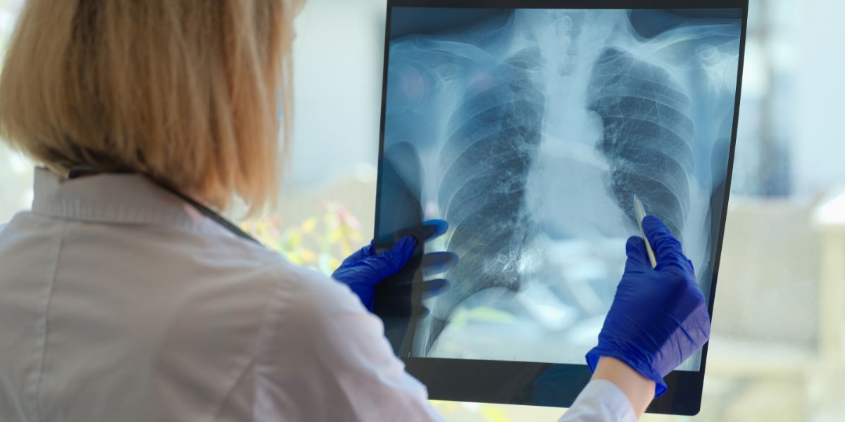 Common Lung Diseases