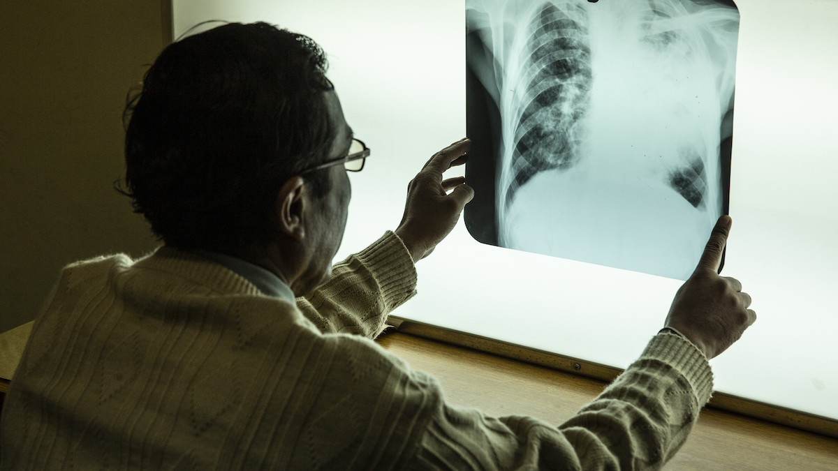 stopping-dust-pollution-high-on-the-agenda-airborne-lung-disease-awareness-grows
